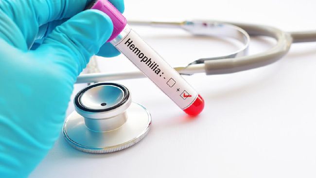 Dari 28 ribu pasien hemofilia yang diperkirakan ada di Indonesia, baru 11 persen yang terdiagnosis. Sisanya belum terjangkau layanan medis.