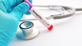 Ada Ribuan Pasien Hemofilia Indonesia yang Diduga Belum Terdeteksi