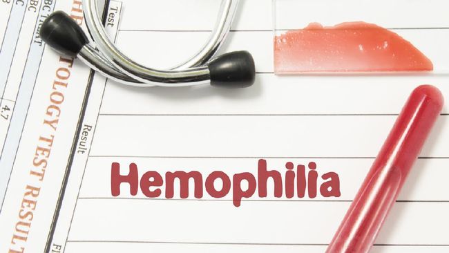 Hemofilia bukan penyakit yang dapat disembuhkan. Tindakan profilaksis menjadi sangat penting bagi pasien hemofilia untuk mencegah pendarahan lebih lanjut.