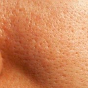 Apakah Pori-Pori Bisa Membesar atau Mengecil?