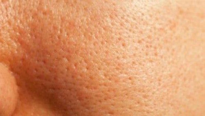 Apakah Pori-Pori Bisa Membesar atau Mengecil?