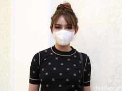 Ibu Masuk ICU, Amanda Manopo Gelisah Bukan Main