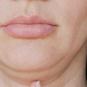 Tips Menghilangkan Double Chin dan Garis Halus di Leher