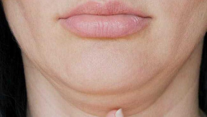 Tips Menghilangkan Double Chin dan Garis Halus di Leher