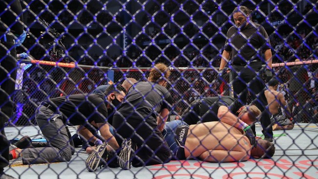 Chris Weidman terancam tak bisa bertarung selama satu tahun di UFC usai mengalami patah kaki di UFC 261.