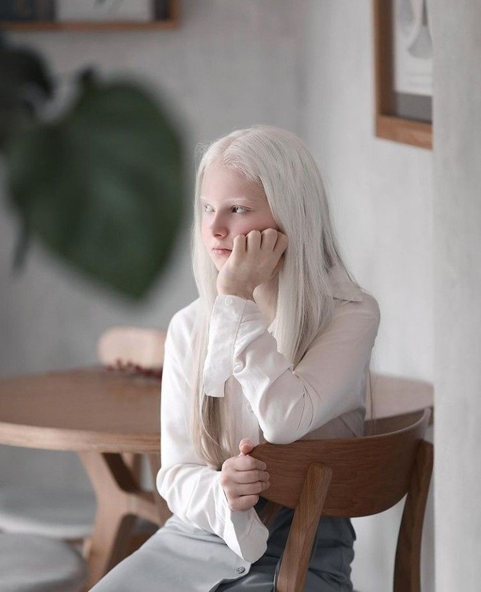 Inilah sosok Amina Ependieva, gadis Albino berusia 11 tahun asal Kurchaloy, kota kecil di Chechnya, Rusia (foto: instagram.com/aminaarsakova)