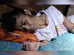Tolong! Kulit Tangan Membusuk, Wanita Pandeglang Ini Tak Bisa Berobat