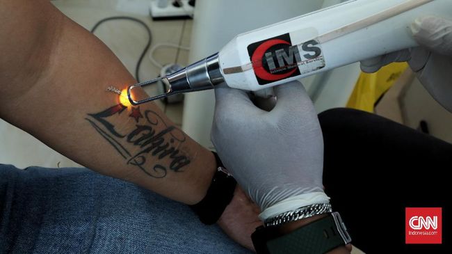 Tato merupakan gambar yang dilukis di kulit tubuh. Bagaimana hukum bertato dalam Islam? Apakah seorang muslim boleh bertato?