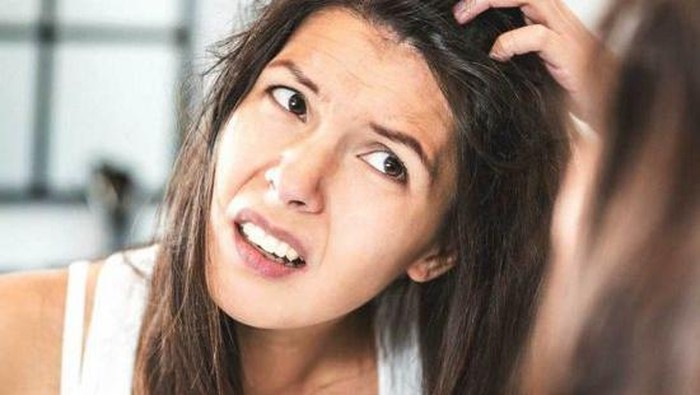 Penyebab Ketombe Basah dan Cara Mengatasinya