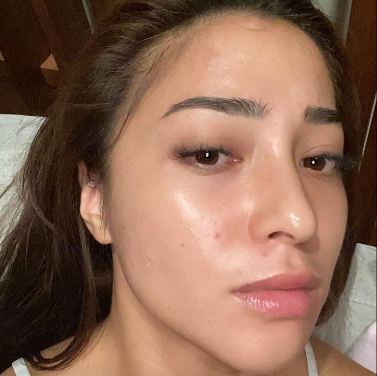 Nikita Willy sempat enggan syuting karena wajahnya dipenuhi oleh jerawat beberapa waktu lalu. Yuk kita lihat bagaimana penampakan wajah Nikita Willy yang penuh jerawat!