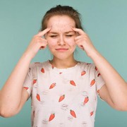 Dijamin Bersih, Begini Cara Mengatasi Bruntusan di Jidat