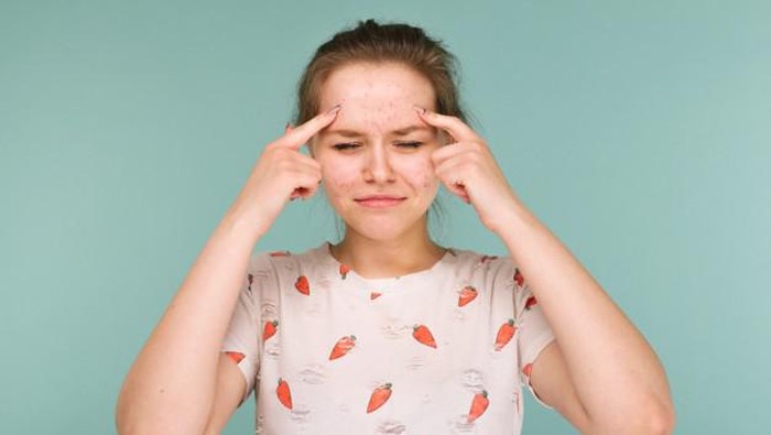 Dijamin Bersih, Begini Cara Mengatasi Bruntusan di Jidat