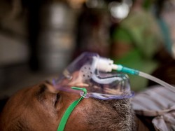 Dokter India Laporkan Jamur Hitam yang Buat Penyintas COVID-19 Buta