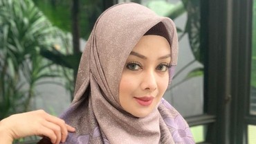 Terry Putri Telat Lapor, Polisi Sulit Ungkap Pelaku Pencurian
