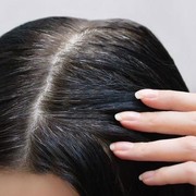 5 Bahan yang Dapat Menghilangkan Uban Secara Alami