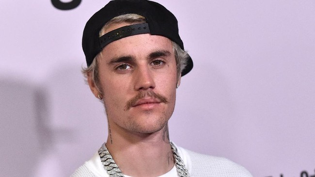 Virus varicella-zoster (VZV) menyebabkan Justin Bieber lumpuh pada bagian wajah. Bagaimana mekanismenya?