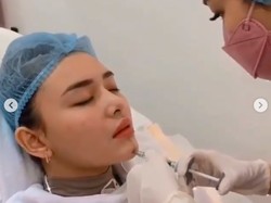 Amanda Manopo Malah Dikritik karena Jalani Perawatan Wajah