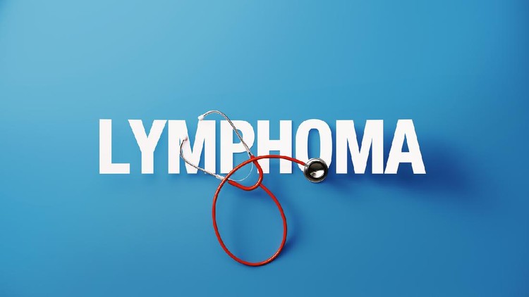 Lymphoma Red stethoscope and lymphoma text on blue background. Health concept. Horizontal composition with copy space. Directly above. Health concept.