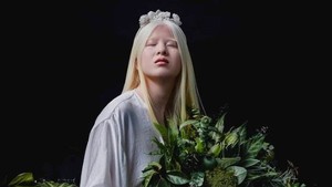 Xueli Abbing, Wanita Albinisme Asal China yang Dibuang Saat Bayi Kini Menjadi Model Vogue