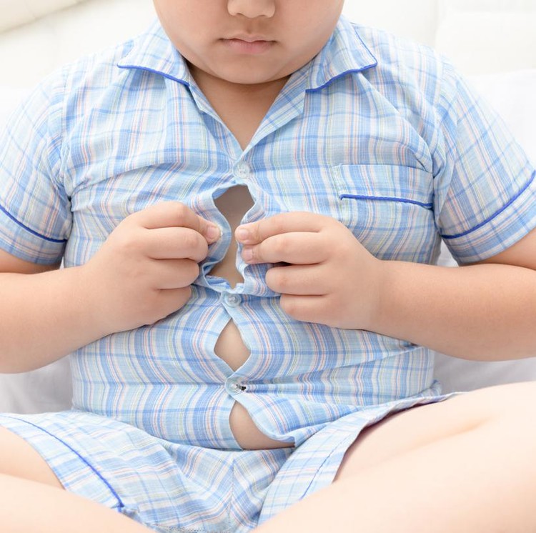 Anak obesitas Anak obesitas