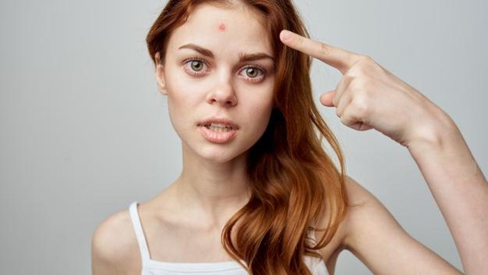 3 Cara Mudah Menutupi Jerawat Tanpa Concealer