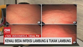 VIDEO: Kenali Beda Infeksi Lambung & Tukak Lambung