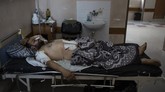 FOTO: RS Gaza Berjuang Lawan Corona dan Luka Perang Beberapa pekan lalu, rumah sakit Gaza sedang berjuang melawan pandemi corona. Kini, rumah sakit berjuang merawat korban luka ledakan hingga amputasi.