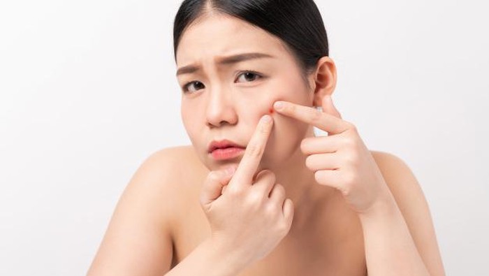 Jerawat Ganggu Aktivitas? Pakai Rekomendasi Obat Totol Jerawat Untuk Kempeskan Jerawat Membandel!