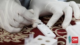 Bahaya Melakukan Tes Swab Antigen Sendiri
