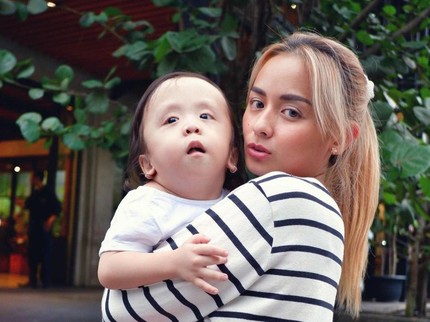 7 Anak Artis Alami Penyakit Langka, Kelainan Genetik hingga Sindrom Berbahaya