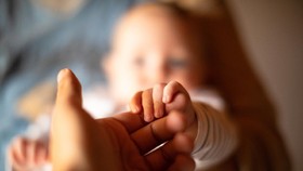 Cutis Laxa, Kondisi Langka Penyebab Bayi Berwajah Keriput