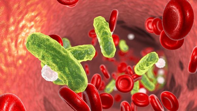 Chicco Jerikho didiagnosis mengalami sepsis. Kenali apa itu sepsis, penyebab, gejala serta pencegahan sepsis.