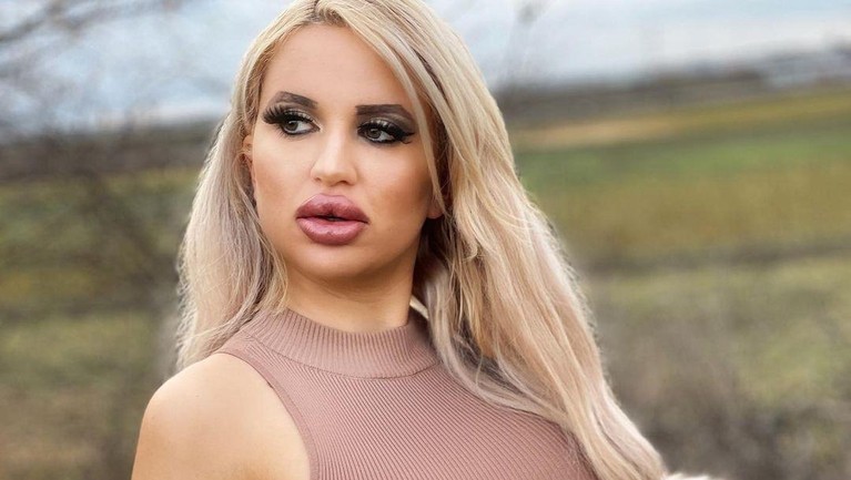 Jessy Bunny Wanita yang Terobsesi Jadi Barbie Terobsesi jadi barbie, Jessy Bunny melakukan oplas dan operasi payudara. Yuk kita lihat bagaimana penampakannya!