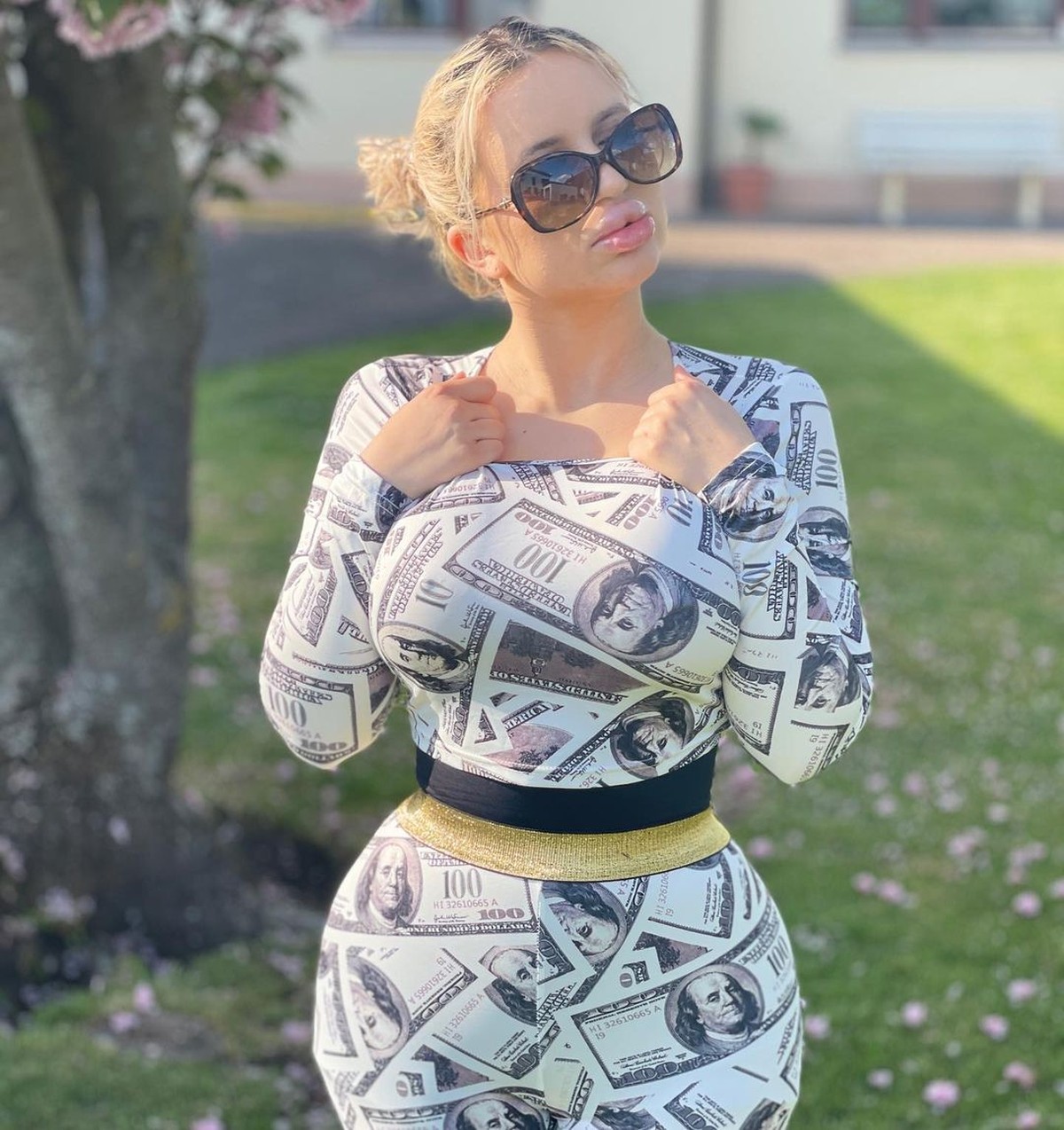 Terobsesi jadi barbie&comma; Jessy Bunny melakukan oplas dan operasi payudara&period; Yuk kita lihat bagaimana penampakannya&excl;