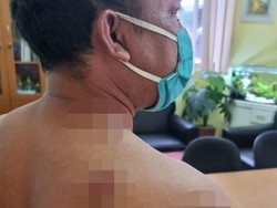 Detik-detik Sopir Taksi Online Ditembak Begal 10 Kali di Lebak