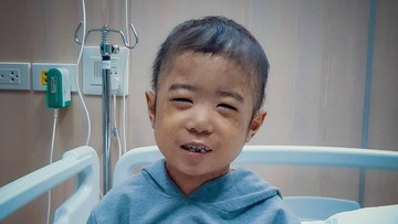 BEDA THALASSEMIA MINOR DAN MAYOR