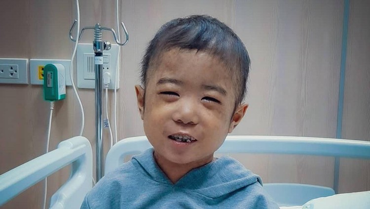 Conan pengidap Thalassemia