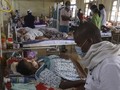 Cerita Penyintas Covid-19 di India Kena Infeksi Jamur Hitam