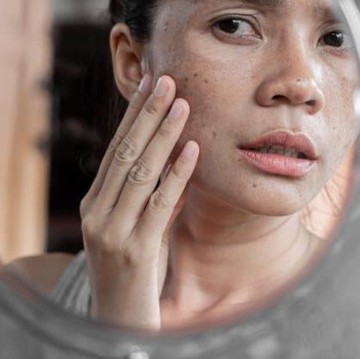 img-title Waspada! Masih Sering Dilakukan, 6 Hal Ini Rupanya Bisa Memicu Noda Hitam di Wajah!
