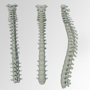Fakta-Fakta Seputar Lordosis, Ketahui Dampaknya Bagi Kesehatan!