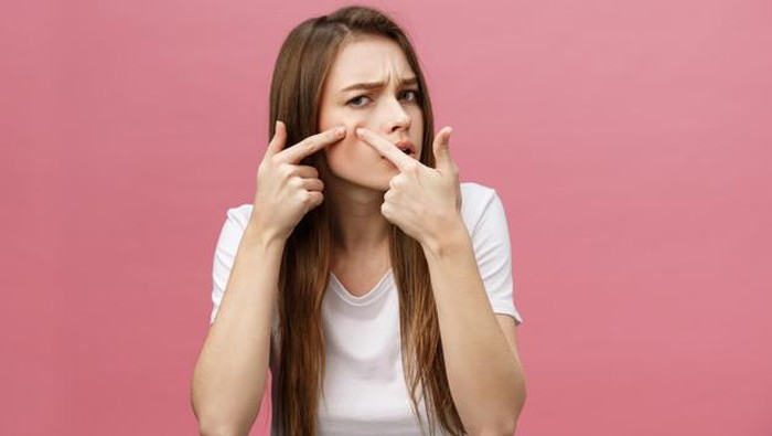 Kulit Jerawatan? 6 Ingredients Berikut Bisa Jadi Andalanmu!