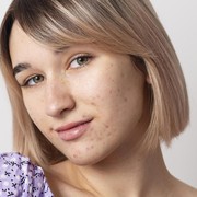 Rekomendasi Primer Hingga Bedak Tabur Untuk Kulit Berjerawat Harga Terjangkau