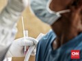 Perbedaan RT-PCR dan iiPCR yang Hasilkan CT Value Ekstrem