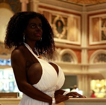 Wanita Ini Ingin Operasi Perbesar Payudara Seukuran Kapal Titanic