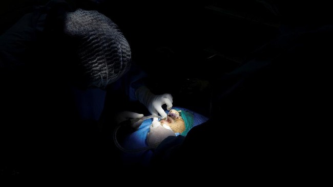 Peneliti dari Inggris mendapati kemungkinan jamur Aspergillus yang berbahaya bakal menyebar ke wilayah-wilayah baru seiring pemanasan global.