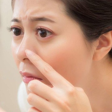 img-title Ini Alasan Kenapa Komedo Putih Muncul Terus-Terusan