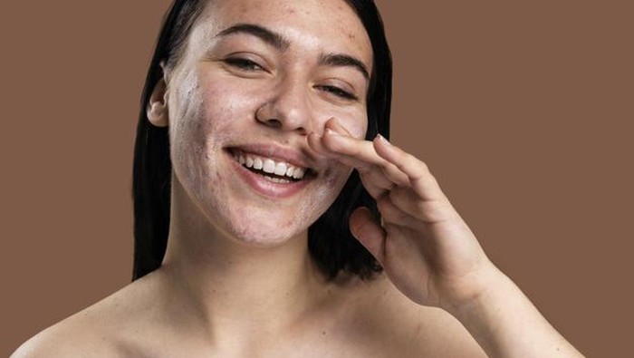 Mengatasi kulit berminyak dan berjerawat/freepik.com