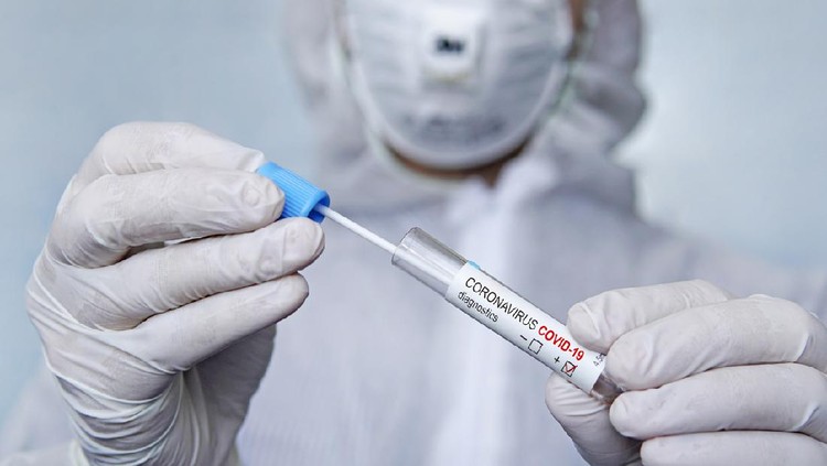 tes COVID-19 Coronavirus 2019-nCoV Sample. New Epidemic Corona Virus. Corona virus outbreaking. Corona Virus in Lab. Scientist hold tube with Test with the Virus Name Coronavirus. sputum examination