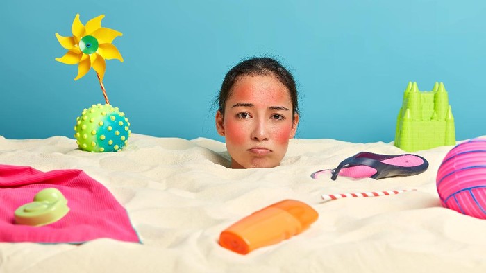Tidak Perlu Bingung Lagi, Ikuti Langkah Berikut Ketika Terkena Sunburn