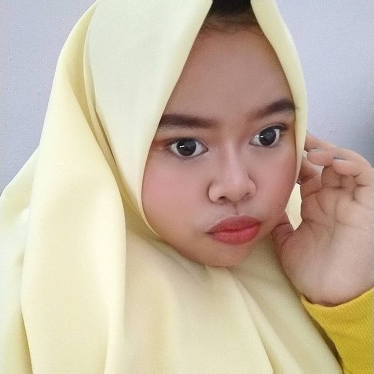 Penampilan Kekeyi Setelah Filler Hidung